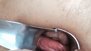 My ass is open – anal masturbation
