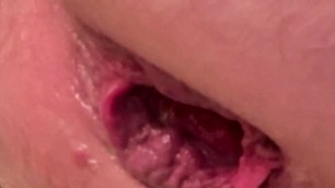 Close up Sissy ass fucking and gape in a skirt